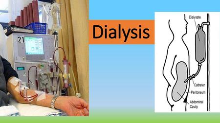 Dialysis.